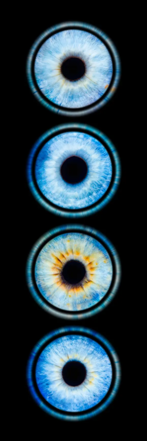 iris vertical